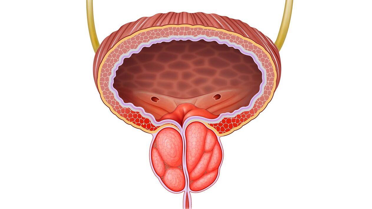 prostate enflammée